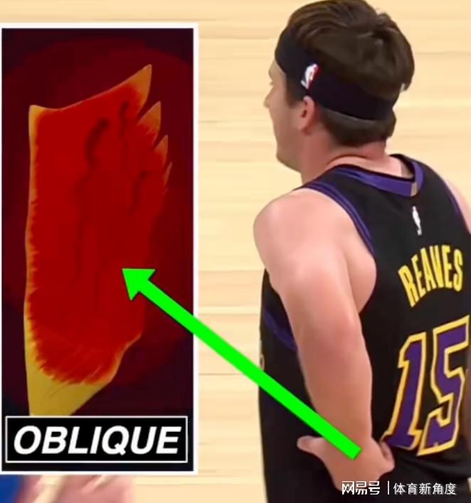  当NBA球星也走投无路：东契奇和里夫斯的欧洲求医之路，藏着多少职业运动员的无奈 体育新闻